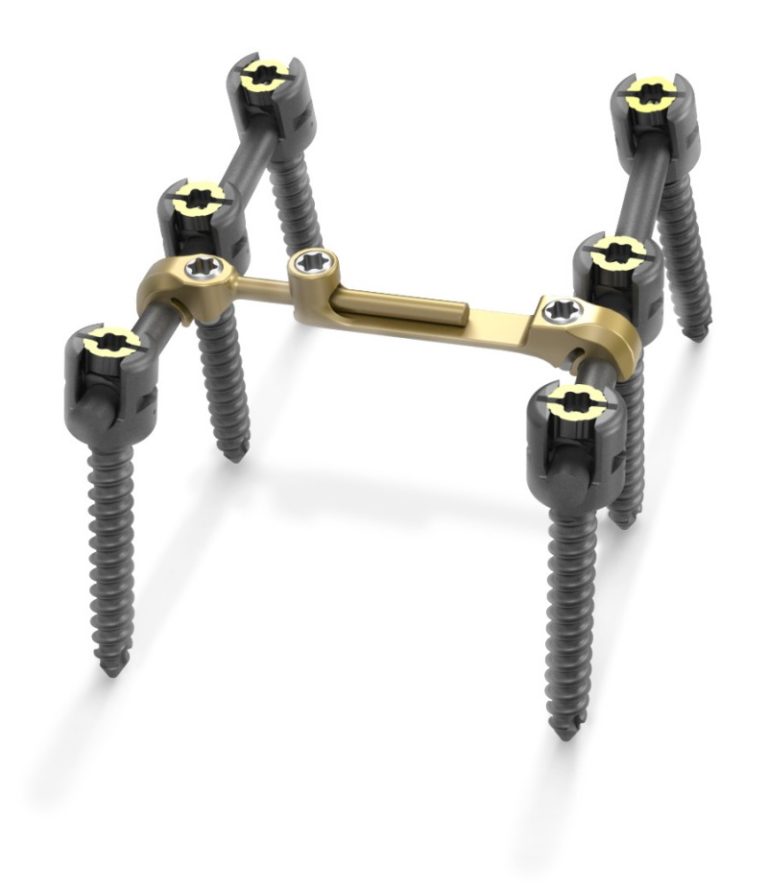 Quantum Spinal Fixation System.
